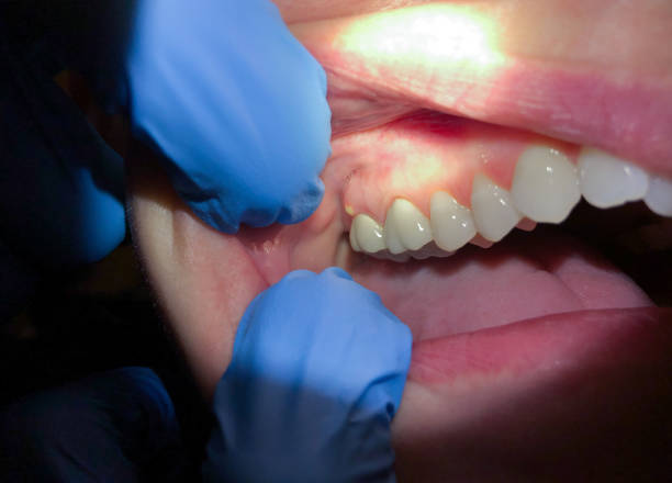 Best Tooth Infection Emergency Dentist  in Birngham, MI