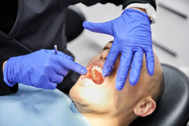 Best Knocked-Out Tooth Emergency  in Birngham, MI